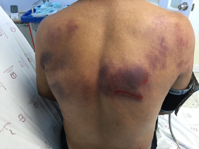 Un hombre falleció luego de haber sido pateado por una vaca